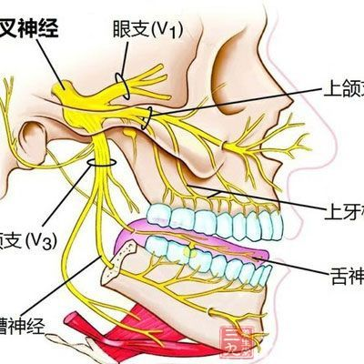 耳朵前面三叉神经痛