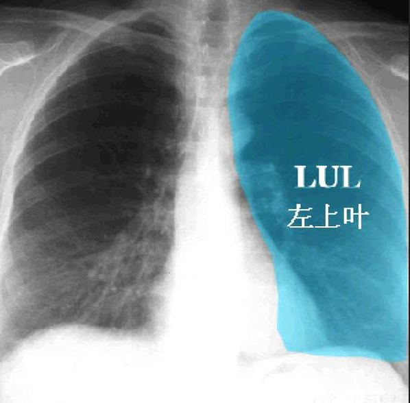 左肺位置图